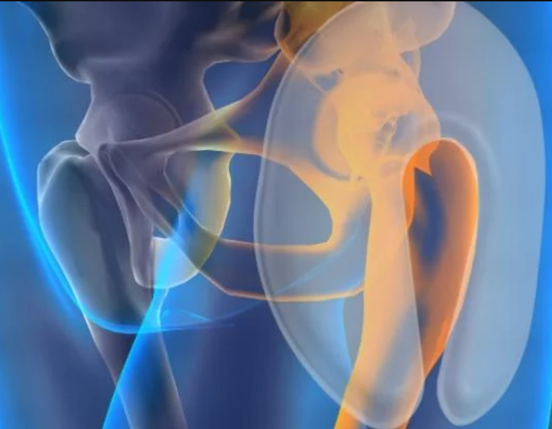 Female Safehip AirX Hip Protector Pant